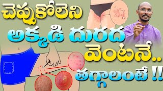 చెప్పుకోలేని అక్కడి దురద వెంటనే  తగ్గాలంటే ..! |Dr. Madhu Babu |  Health Trends |