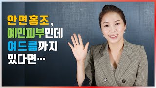 홍조 예민피부인데 여드름까지 있다면 이 영상을 꼭 보세요!!!