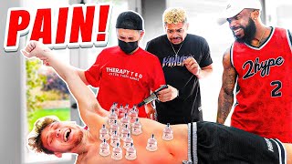 2HYPE EXTREME Cupping and Adjustment Therapy *WORST PAIN EVER*