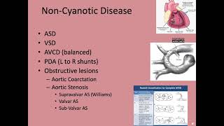 Congenital Topics Ganta 1