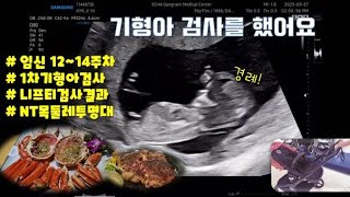 [임신일기-4] 12~14주 드디어 무시무시한 기형아 검사.. 니프티..!!