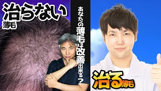 【薄毛改善】あなたの薄毛は改善できる？治る薄毛、治らない薄毛。(毛髪専門医が解説)