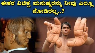 ಈ ರೀತಿಯ ವಿಚಿತ್ರ ಮನುಷ್ಯರನ್ನು ನೀವು ಎಲ್ಲೂ ನೋಡಿರಲ್ಲ... ? || Interesting and unknown facts in kannada