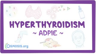 Hyperthyroidism: Nursing Process (ADPIE)