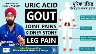 Why do you have HIGH URIC ACID Problem | GOUT | KIDNEY STONE | JOINT PAIN | Dr.Education (Hin + Eng)