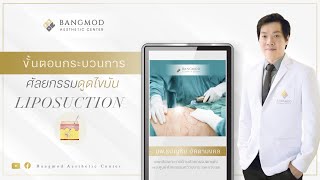 ขั้นตอนกระบวนการ #ศัลยกรรมดูดไขมัน Liposuction  | คุณ #หมอธนัญชัย