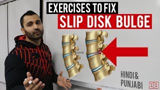 Fix SLIP DISC BULGE Back Pain at Home! (Hindi / Punjabi)