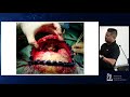 Cranial Anatomy - Michael Y. Yang, MD, FACS