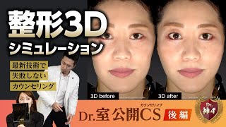 3Dシュミレーションで整形後の顔が分かる！最新医療を駆使した公開カウンセリングを大紹介！