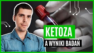 Wpływ diety ketogenicznej na wyniki badań | Hack Your Brain | #shorts