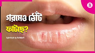 গরমে ঠোঁট ফাটা কীসের লক্ষণ  ।। Chapped lips in summer, why?