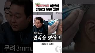 보물섬의 탈모포지션 이현석, 말하지 못한 고민