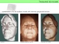 Facial topometry using pulsed holography