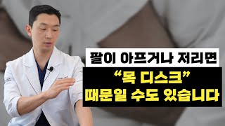 팔이 아프거나 저리면 '목 디스크' 때문일 수도 있습니다!!