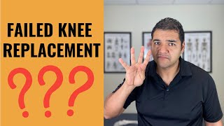4 Signs You Possibly Have A Failed Knee Replacement