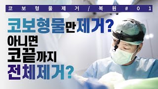 🔸코보형물제거🔸콧대보형물만 제거 VS 콧대+코끝 전체제거❗ 제대로 제거하려면?