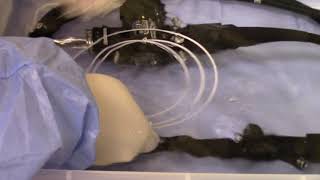 Endoscopy Technician - Using a Channel Cleaning Brush Part 2 | AIMS Education