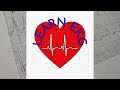 ekg analysis idioventricular rhythm