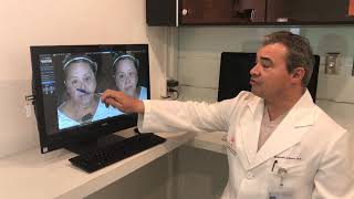 Dr. Alejandro Quiroz | 3D Imaging for Facelift Surgery