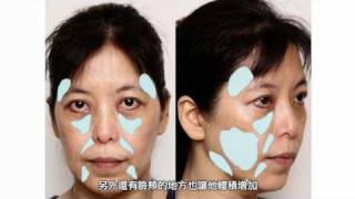 ((原廠獨家))Sculptra3D聚左旋乳酸‧舒顏萃台灣發表會