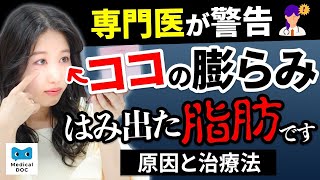 加齢と共に生じる目の下のたるみ…専門医が治療法を教えます！！【教えてドクター】