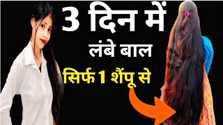 शैंपू में यह मिलाकर लगाया 3 दिन में बाल लंबे हो गए,बाल लंबा करने का तरीक़ा hairgrowth.sampolong hair