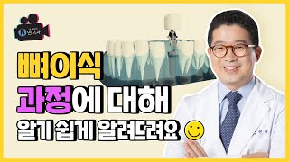 임플란트방법 뼈이식 치료 과정이 궁금했다면~?!(If you were curious about the bone transplant treatment process?)