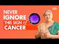 Most common signs of cancer | Symptoms of cancer you shouldn't ignore | How to spot cancer early
