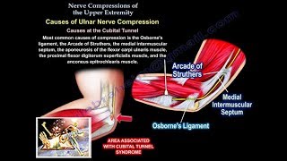 Nerve Compressions Of The Upper Extremity - Everything You Need To Know - Dr. Nabil Ebraheim