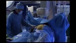 BHC - L'endovalve