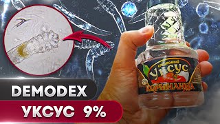 Уксус 9% против клеща | Угревая Железница Demodex