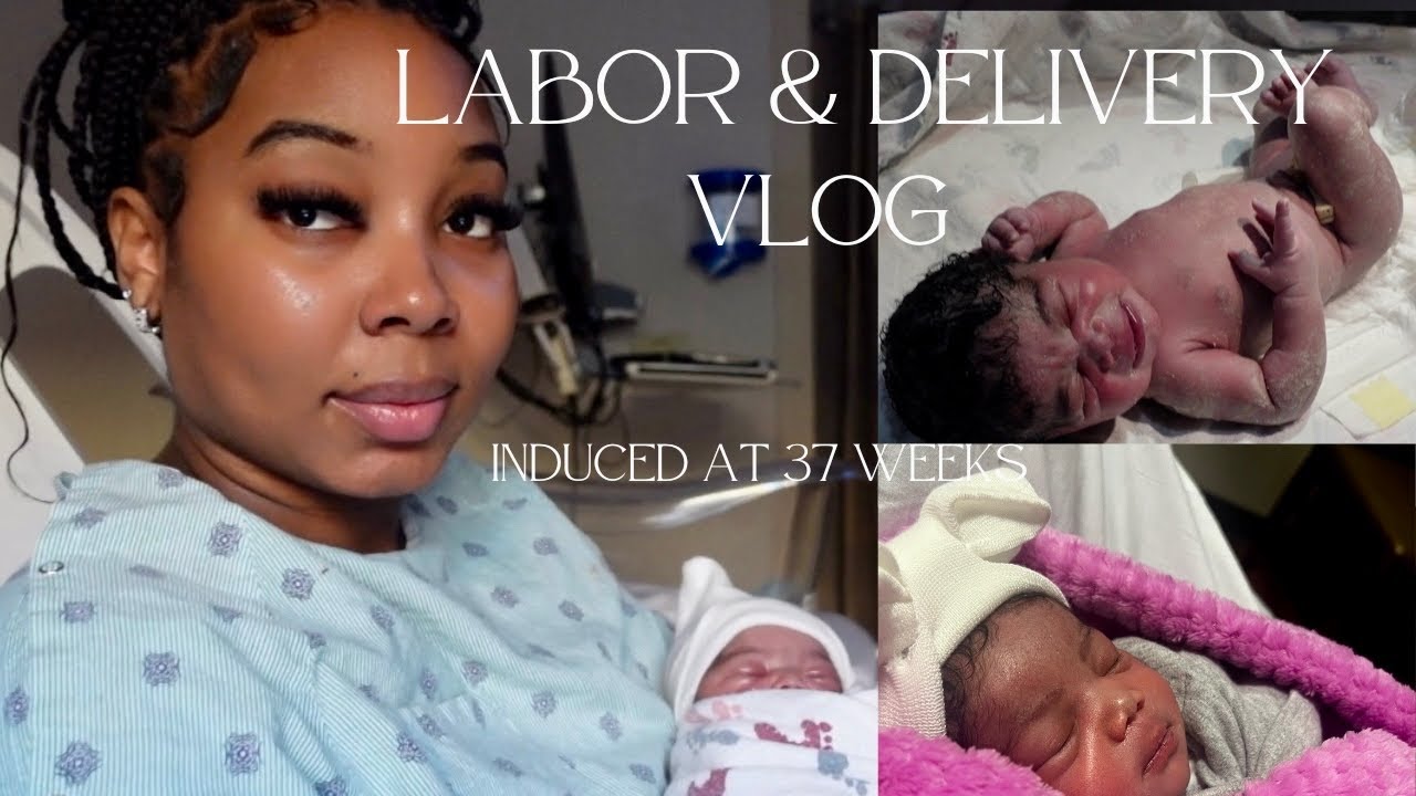 Is Being Induced At 37 Weeks Safe At Richard Jett Blog