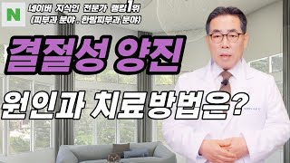 4K)결절성 양진은 체온조절 작용이 정상적으로 이루어지면 치료되는 증상입니다.