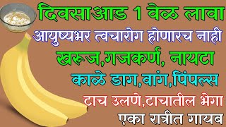 कसलाही भयानक त्वचारोग तीन दिवसात बरा,वांग,काळेडाग कायमचा खात्मा, गजकर्ण,नायटा, संपवा,टाचउलणे रात्रीत