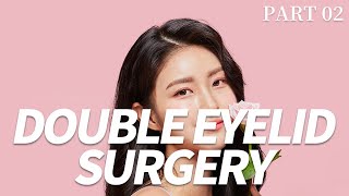 SUB) All About Korean Double Eyelid Surgery PART02 [Miview Talk Talk]