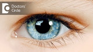 What can cause watery eyes? - Dr. Sriram Ramalingam