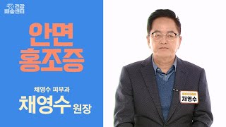 겨울철에 유난히 심해지는 '이것'