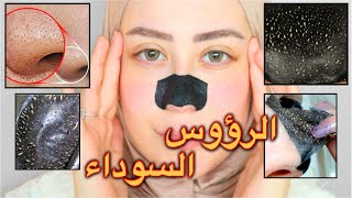 اسهل الطرق لازاله الرؤوس السوداء بالمنزل 😍 || شهد ناصر 🌸