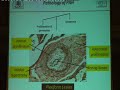 Pulmonary Hypertension & Pulmonary Embolism