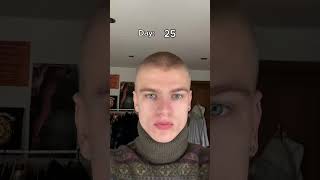 It Won’t Grow Back…