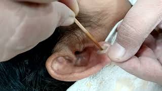 Ear Lobe Repair | Ear Cut Repair | Ear lobe Pasting.