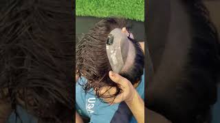 Hair Patch Clip System | Hair Patch Clipping System for Men in Delhi #shorts #youtubeshorts