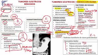 Tumores Gástricos