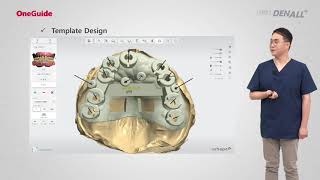 Oneguide: ep 4 OneCAS System Understanding and Clinical Applications