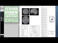 spm tutorial 04 normalisation