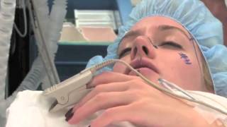 Heidi Montag Gets Breast Reduction, Regrets F Implants | Splash News TV | Splash News TV