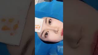 美丽的大眼睛姑娘#整形 #医美 #眼综合#眼袋Beautiful girl with big eyes