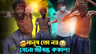 মানুষ তো নয় যেনো জীবন্ত কঙ্কাল | Shocking True Story | Street Humanity of Bangladesh