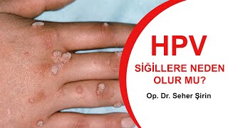 Hpv'nin Sebep Olduğu Siğil ve kondilom'da Kanser Kadar Önemsenmesi Gereken Bir Hastalıktır