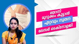 V-Tightening | Vaginal Tightening | യോനി മുറുക്കം ലഭിക്കാൻ നൂതന ലേസർ ചികിത്സ